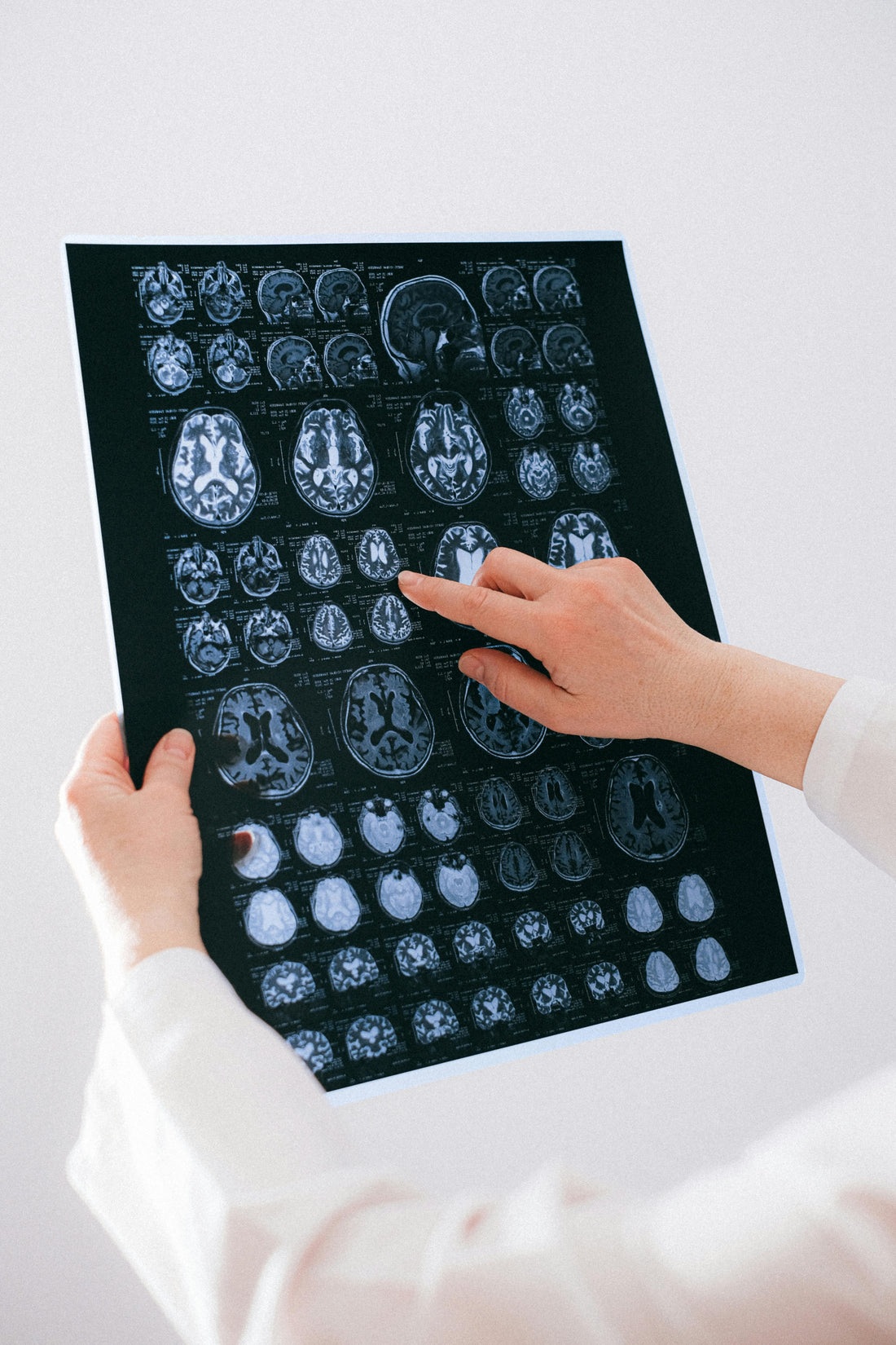 Omega-3 Fatty Acids — The Heart, Brain, and Joint Protector