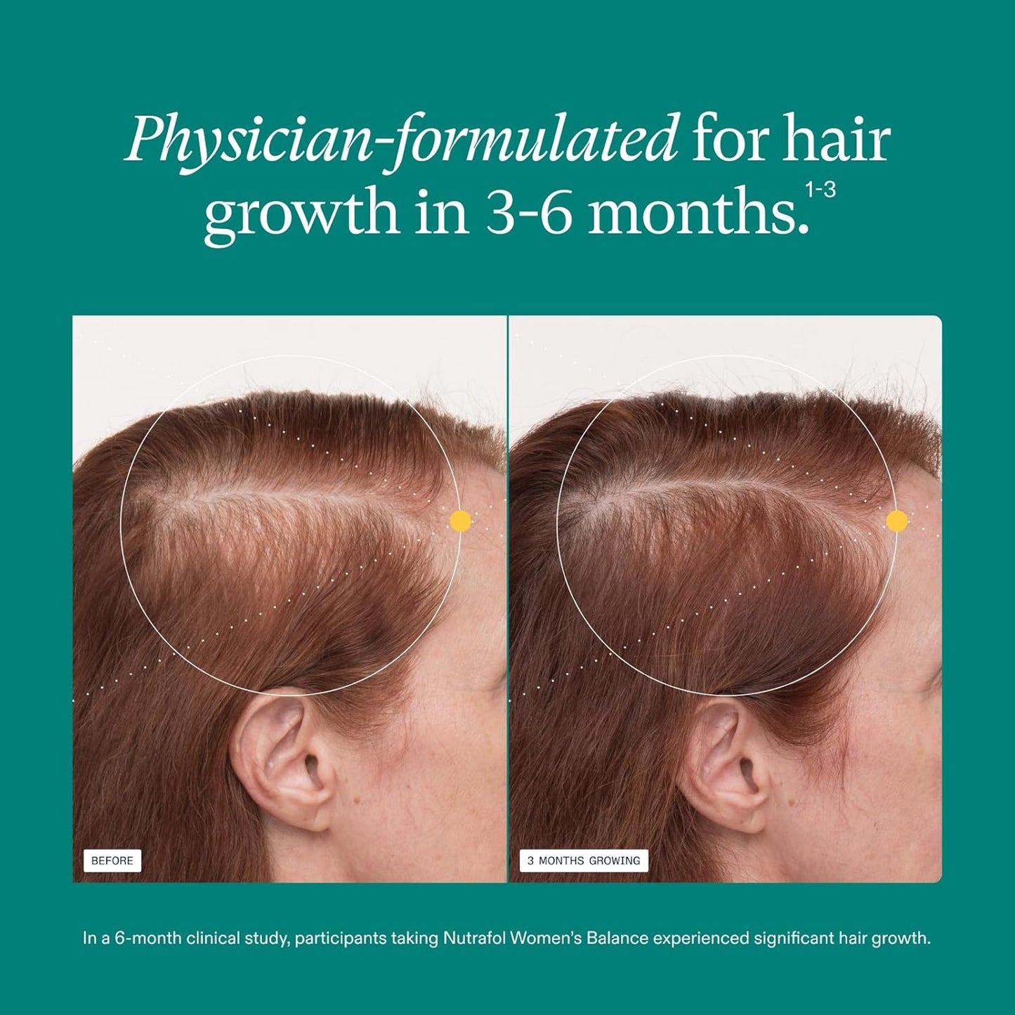 Nutrafol Women's Hair Growth Supplements, Ages 18-44