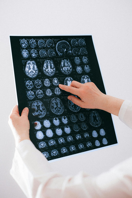 Omega-3 Fatty Acids — The Heart, Brain, and Joint Protector