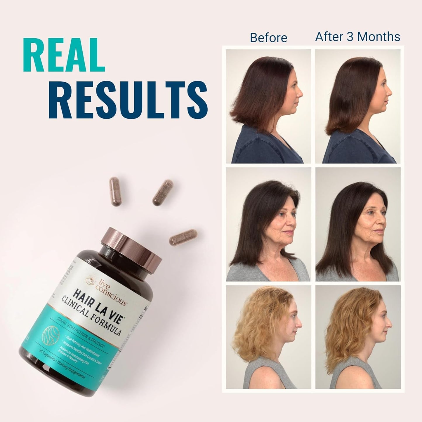 Hair La Vie Live Conscious Clinical Formula Hair Growth Vitamins for Women and Men