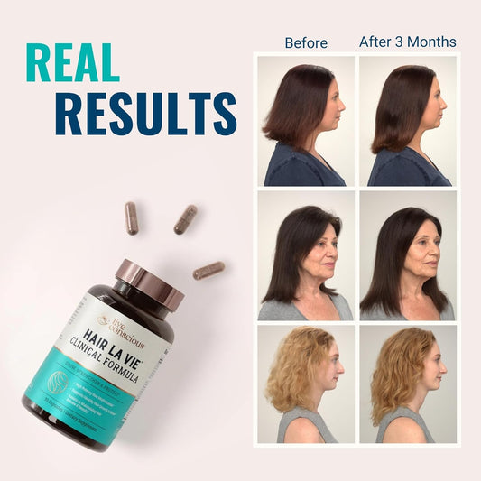 Hair La Vie Live Conscious Clinical Formula Hair Growth Vitamins for Women and Men