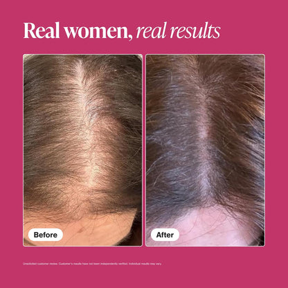 Viviscal Hair Growth Supplements For Women For Thicker, Fuller Hair