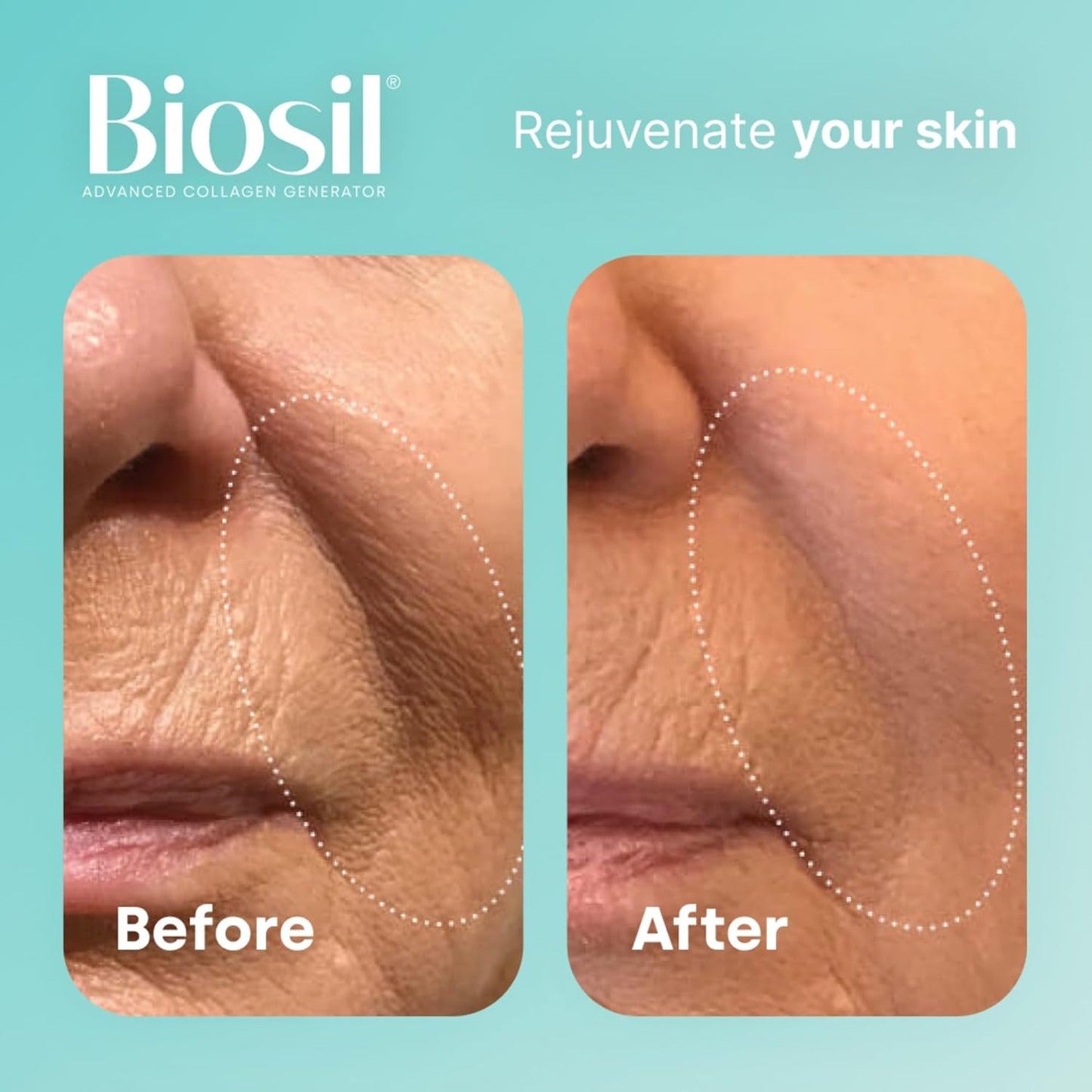 Biosil Collagen Generator - 120 Original Capsules - GMO Free - 60-Day Supply